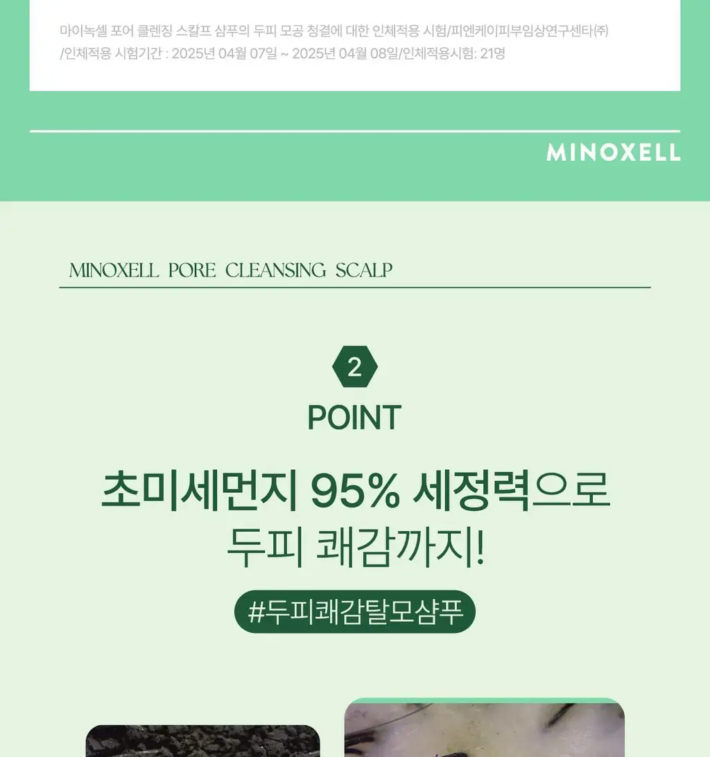 [허경환 PICK/현대약품특허]마이녹셀 포어클렌징 스칼프 샴푸 480ml 상세페이지 19